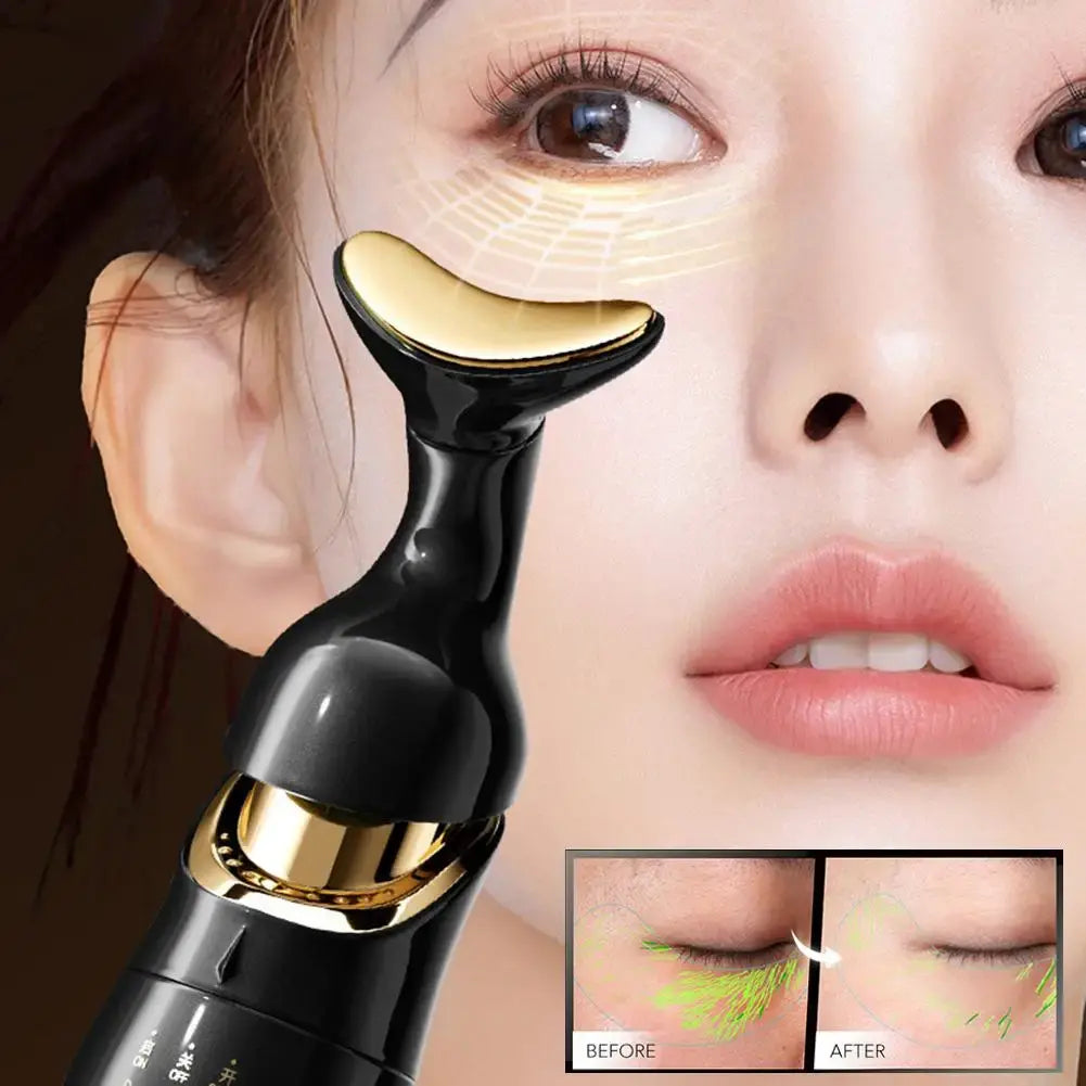 AuraGlow Eye Massager Black Gold Head Applied Under Eye Area Woman Before After Dark Circles Puffiness Reduction